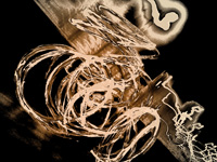 Images V. Franck